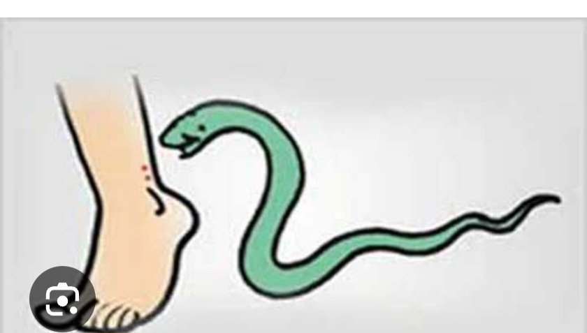 किशोरी को सांप ने डसा, इलाज के बाद बची जान